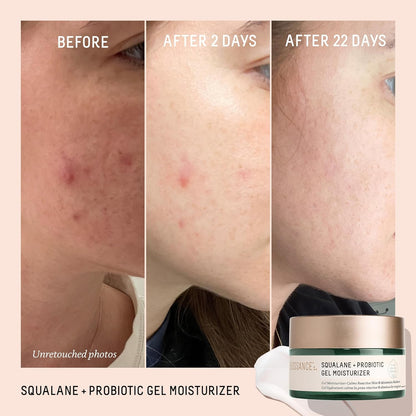 BIOSSANCE Squalane + Probiotic Balancing Gel Moisturizer