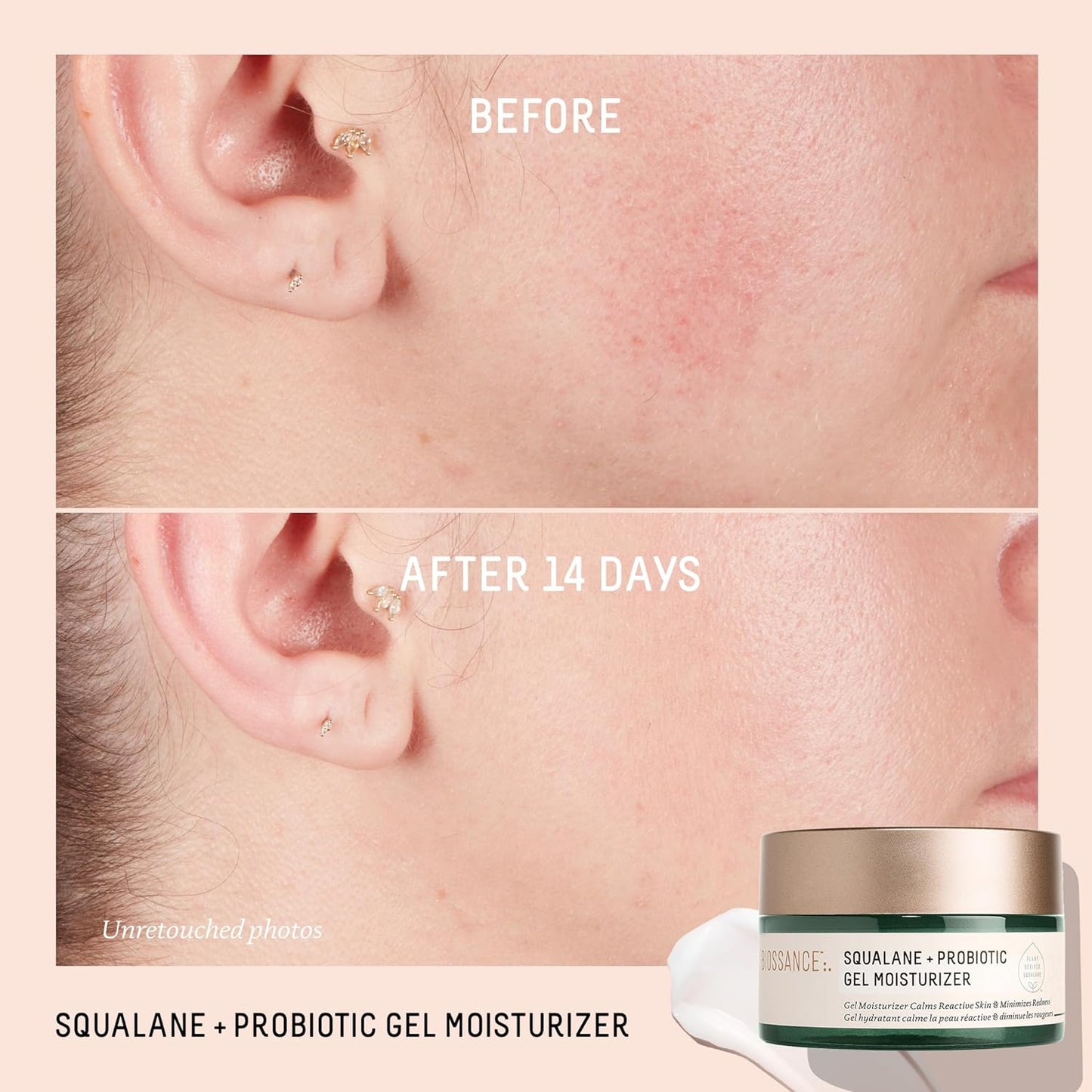 BIOSSANCE Squalane + Probiotic Balancing Gel Moisturizer